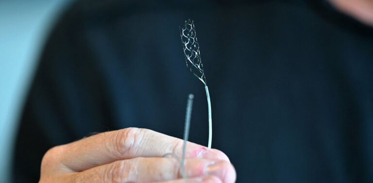 Experimental brain implants are on the rise. What happens after the trials are over?